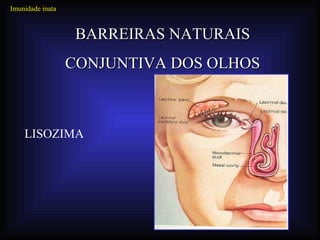 Imunidade inata


                   BARREIRAS NATURAIS
                  CONJUNTIVA DOS OLHOS



    LISOZIMA
 