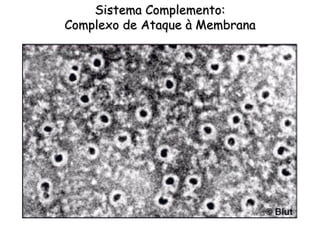Sistema Complemento:
Complexo de Ataque à Membrana
 