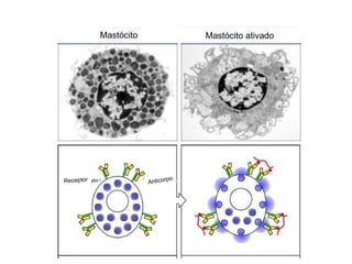 Mastócito               Mastócito ativado




Receptor                      po
                       Anticor
 