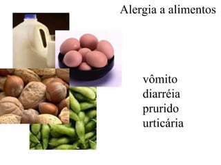 Alergia a alimentos




    vômito
    diarréia
    prurido
    urticária
 