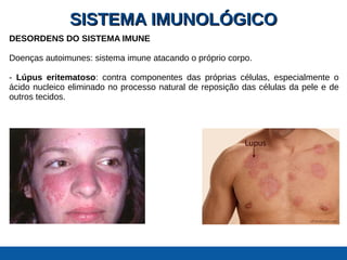 SISTEMA IMUNOLÓGICOSISTEMA IMUNOLÓGICO
DESORDENS DO SISTEMA IMUNE
Doenças autoimunes: sistema imune atacando o próprio corpo.
- Lúpus eritematoso: contra componentes das próprias células, especialmente o
ácido nucleico eliminado no processo natural de reposição das células da pele e de
outros tecidos.
 