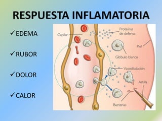 GANGLIO LINFÁTICOBazo