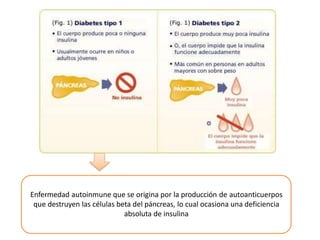 Enfermedad autoinmune que se origina por la producción de autoanticuerpos
que destruyen las células beta del páncreas, lo cual ocasiona una deficiencia
absoluta de insulina
 