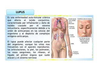 LUPUS
 