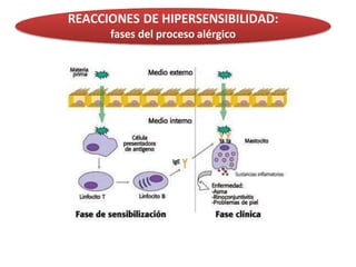 REACCIONES DE HIPERSENSIBILIDAD:
fases del proceso alérgico
 