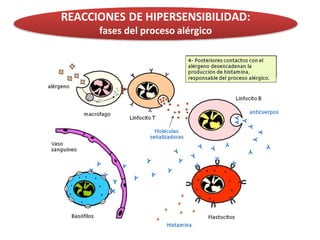REACCIONES DE HIPERSENSIBILIDAD:
fases del proceso alérgico
 