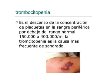 trombocitopenia Es el descenso de la concentración  de plaquetas en la sangre periférica por debajo del rango normal 150.000 a 400.000/ml la tromcitopenia es la causa mas frecuente de sangrado. 