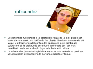rubicundez Se denomina rubicundez a la coloración rojiza de la piel  puede ser secundaria a vasoconstricción de los plexos dérmicos  a anomalía de la piel y altracinones del contenidos sanguíneo este cambio de coloración de la piel puede ser difuso pero suele ser  ser mas manifiesto en la cara  dando lugar a la facia eritrositica . La rubicundez puede ser episódica  como ocurre cunado se produce vasodilatación desencadenada por una emoción eritema. 