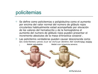 policitemias Se define como policitemias o poliglobulina como el aumento por encima del valor normal del numero de glóbulo rojos circulantes habitualmente estad acompañado por elevación de los valores del hematocrito y de la hemoglobina el aumento del numero de glóbulo rojos pueden presentar el incremento absolutos de la masa eritrositica corporal . Las policitemis verdaderas pueden causar desconocida como las policitemis veras que se incluye dentro del síndrome míelo proliferativo. 
