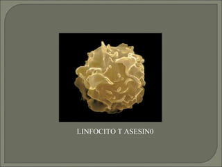 LINFOCITO T ASESIN0 