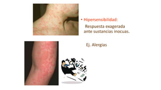 • Hipersensibilidad:
Respuesta exagerada
ante sustancias inocuas.
Ej. Alergias
 
