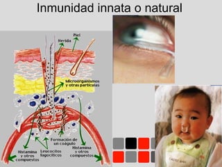 Inmunidad innata o natural
 