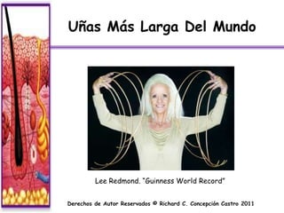 Uñas Más Larga Del Mundo




         Lee Redmond. “Guinness World Record”


Derechos de Autor Reservados © Richard C. Concepción Castro 2011
 