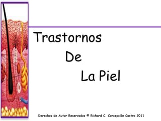Trastornos
     De
       La Piel

Derechos de Autor Reservados © Richard C. Concepción Castro 2011
 