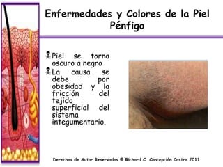 Enfermedades y Colores de la Piel
            Pénfigo

 Piel   se torna
  oscuro a negro
 La causa se
  debe         por
  obesidad y la
  fricción     del
  tejido
  superficial del
  sistema
  integumentario.



  Derechos de Autor Reservados © Richard C. Concepción Castro 2011
 