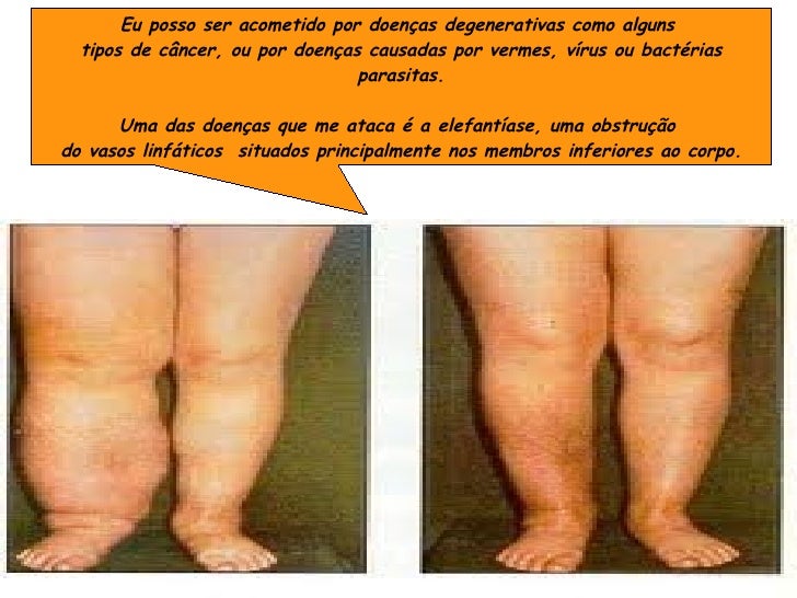 Que parasitas em coração