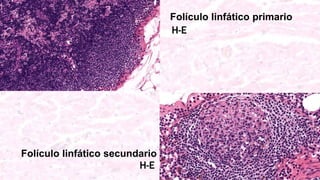 Folículo linfático primario
Folículo linfático secundario
H-E
H-E
 