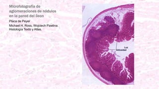 Microfotografía de
aglomeraciones de nódulos
en la pared del íleon
Placa de Peyer
Michael H. Ross, Wojciech Pawlina.
Histología Texto y Atlas.
 