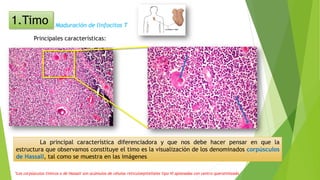 1.Timo
Principales características:
Maduración de linfocitos T
*Los corpúsculos tímicos o de Hassall son acúmulos de células reticuloepiteliales tipo VI aplanadas con centro queratinizado
La principal característica diferenciadora y que nos debe hacer pensar en que la
estructura que observamos constituye el timo es la visualización de los denominados corpúsculos
de Hassall, tal como se muestra en las imágenes
 