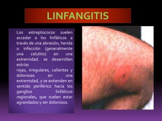  Drenan el labio inferior, el mentón, la encía inferior, el piso de la boca y la cara inferior de la lengua.Ganglios Retrofaringeos Situados a la altura de las masas laterales del atlas, delante de la hoja prevertebral de la fascia cervical, en contacto con la pared posterior de la faringe. Ganglios Yugulodigástricos Ubicados en el cruce de la vena yugular interna y el vientre posterior del digástrico