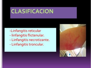  Recibe eferentes de la faringe, la trompa auditiva, la cavidad timpánica, la lengua, la amígdala palatina.