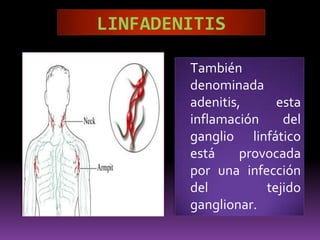 Ganglios Cervicales Anteriores Todos están situados por debajo del hueso hioides. Se distinguen: