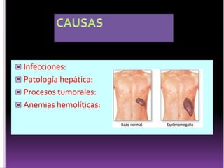 Ganglios Linfáticos Parietales Ganglios Intercostales:- Asientan en la extremidad posterior del espacio   intercostal y en la región paravertebralReciben eferentes de los músculos intercostales, el tejido conjuntivo subpleural y la pleura parietal