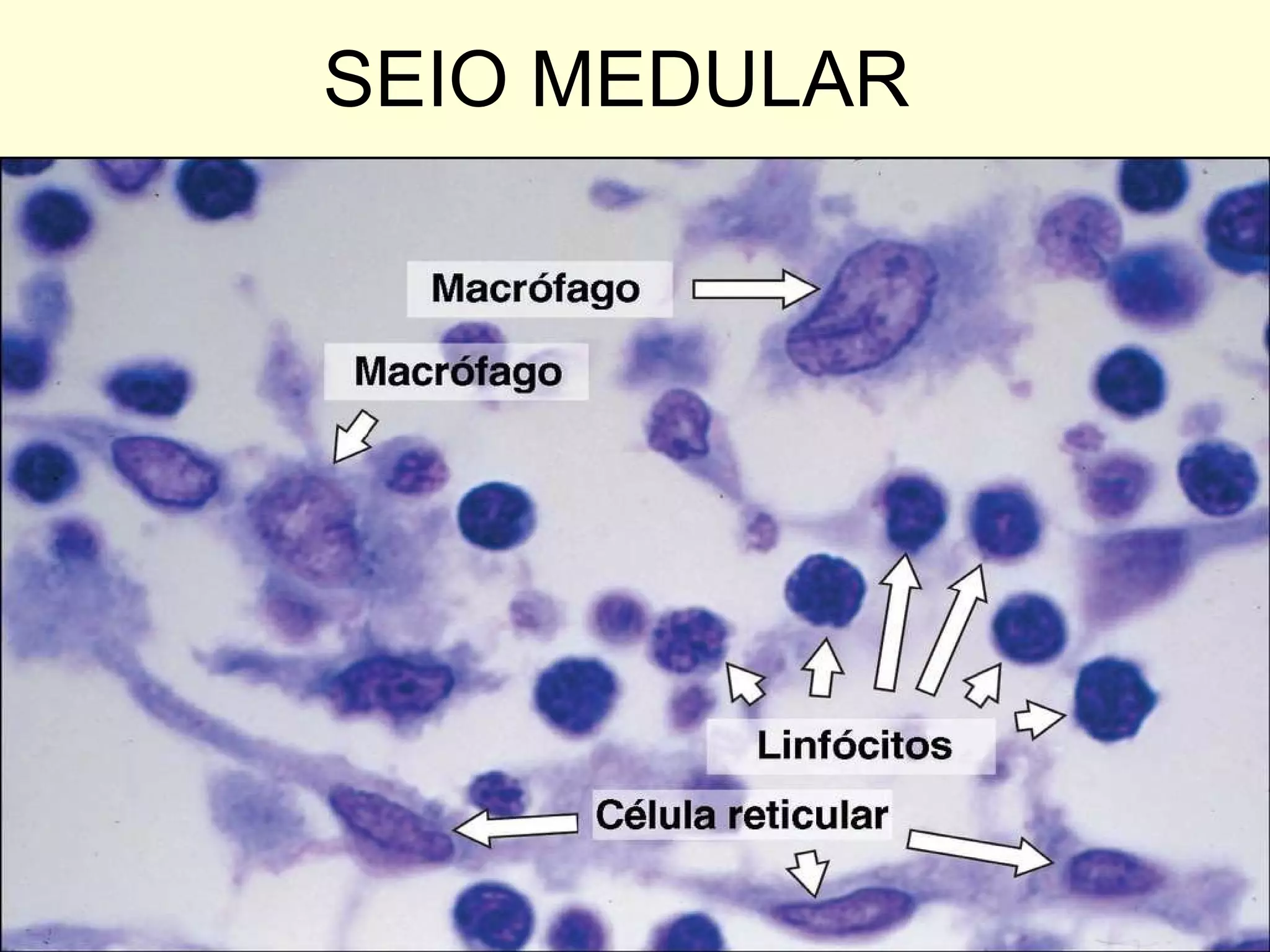 SEIO MEDULAR 