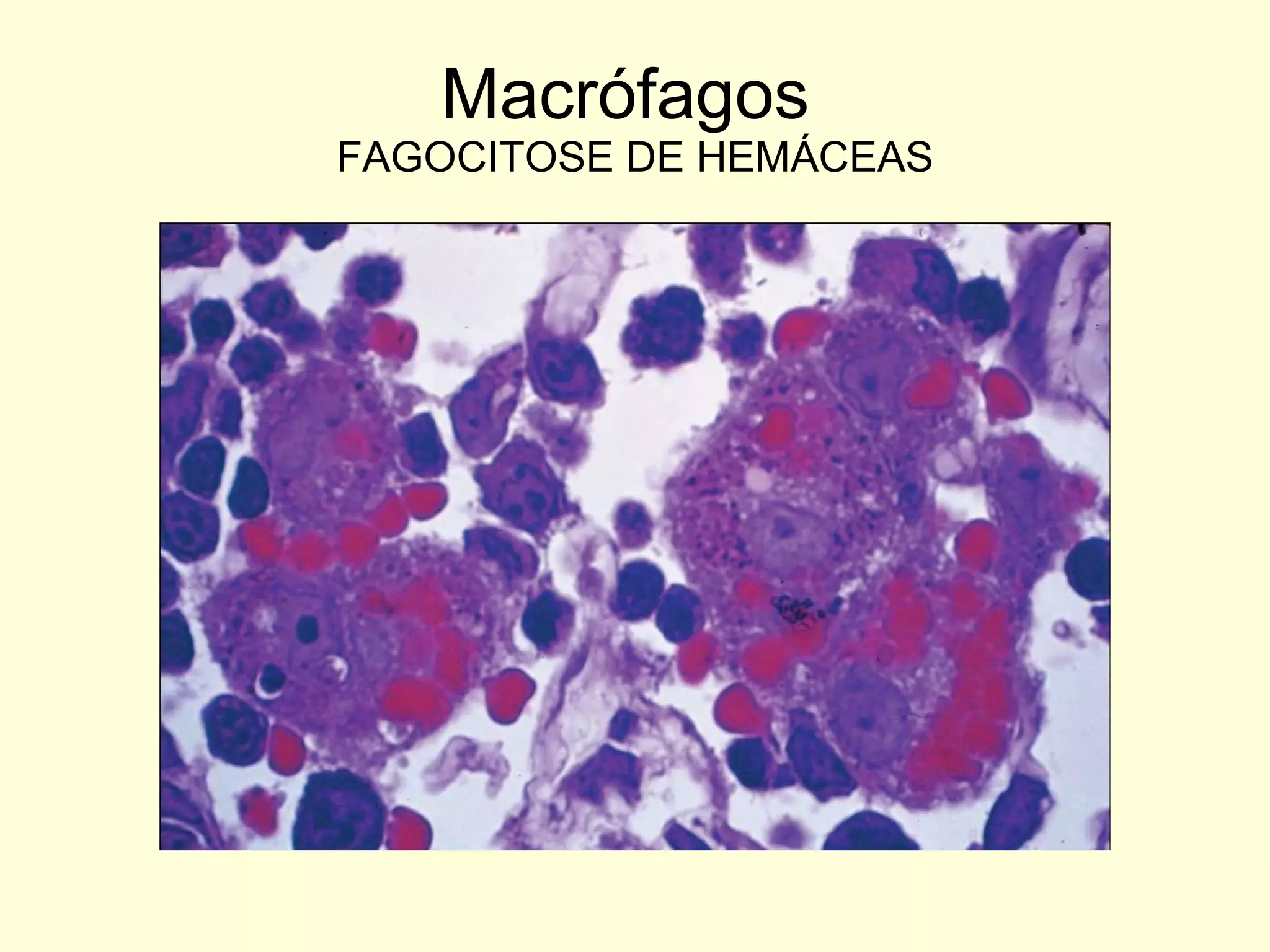 Macrófagos  FAGOCITOSE DE HEMÁCEAS 
