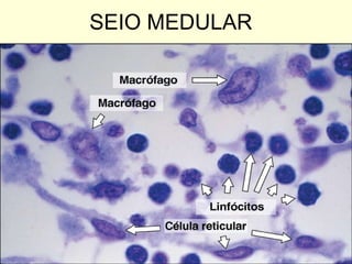 SEIO MEDULAR 