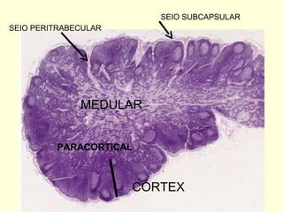 SEIO SUBCAPSULAR MEDULAR CÓRTEX SEIO PERITRABECULAR PARACORTICAL 