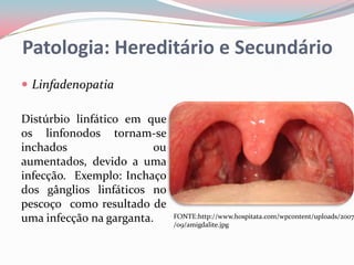 Patologia: Hereditário e Secundário
 Linfadenopatia

Distúrbio linfático em que
os linfonodos tornam-se
inchados                 ou
aumentados, devido a uma
infecção. Exemplo: Inchaço
dos gânglios linfáticos no
pescoço como resultado de
uma infecção na garganta.     FONTE:http://www.hospitata.com/wpcontent/uploads/2007
                              /09/amigdalite.jpg
 