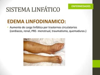 SISTEMA LINFÁTICO

ENFERMEDADES

EDEMA LINFODINAMICO:
• Aumento de carga linfática por trastornos circulatorios
(cardiacos, renal, PRE- menstrual, traumatismo, quemaduras.)

 