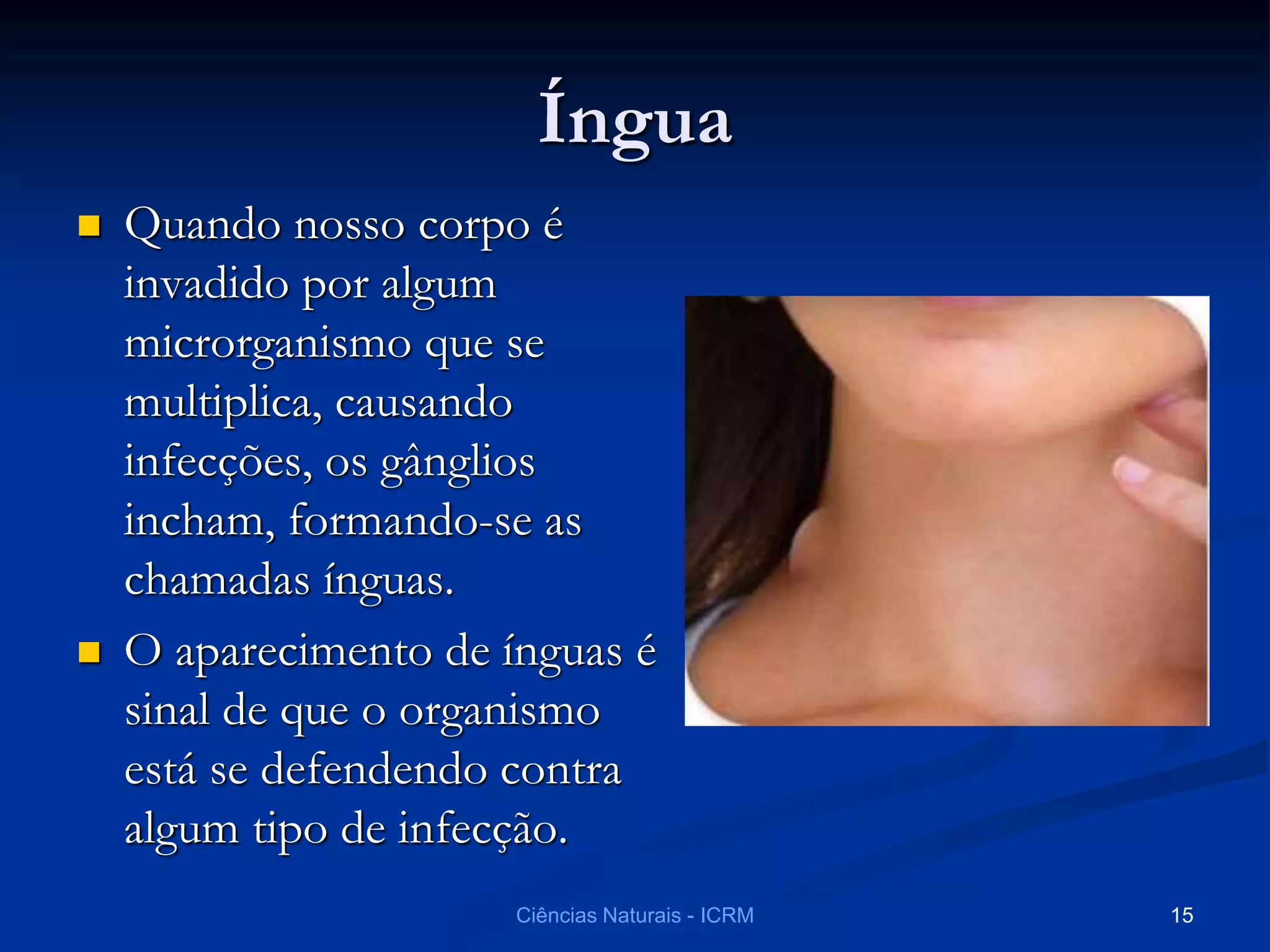Íngua
 Quando nosso corpo é
invadido por algum
microrganismo que se
multiplica, causando
infecções, os gânglios
incham, formando-se as
chamadas ínguas.
 O aparecimento de ínguas é
sinal de que o organismo
está se defendendo contra
algum tipo de infecção.
Ciências Naturais - ICRM 15
 