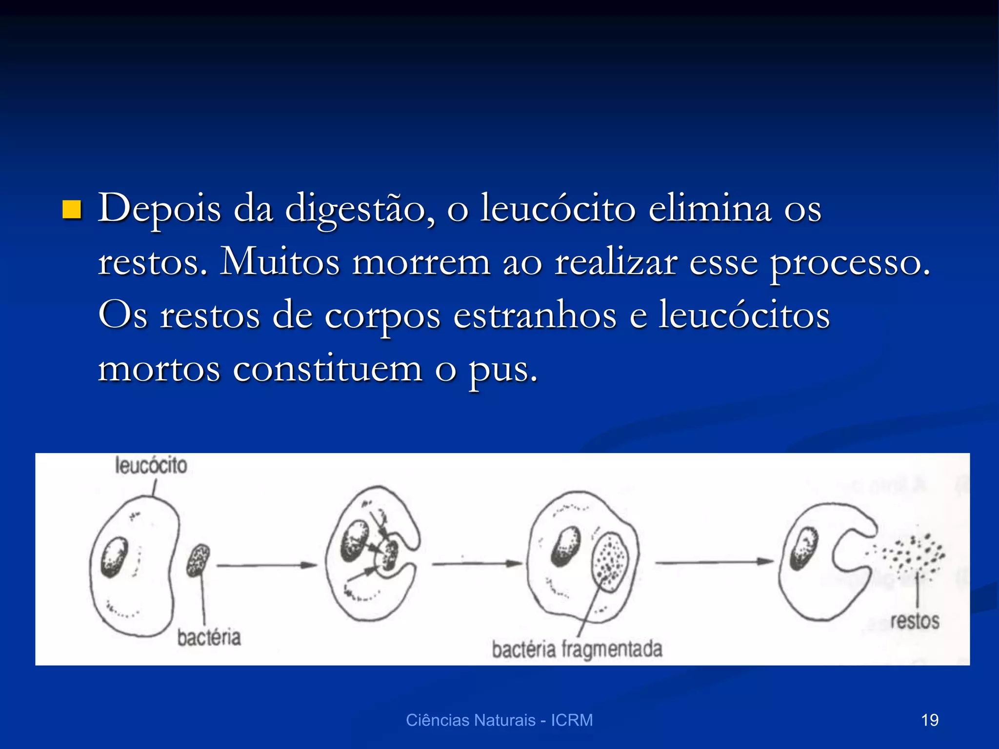  Depois da digestão, o leucócito elimina os
restos. Muitos morrem ao realizar esse processo.
Os restos de corpos estranhos e leucócitos
mortos constituem o pus.
Ciências Naturais - ICRM 19
 