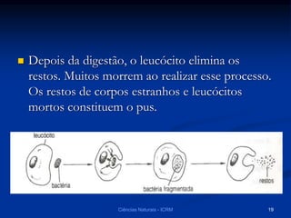  Depois da digestão, o leucócito elimina os
restos. Muitos morrem ao realizar esse processo.
Os restos de corpos estranhos e leucócitos
mortos constituem o pus.
Ciências Naturais - ICRM 19
 