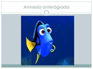 Amnesia anterógrada

 