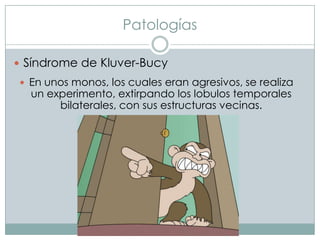 Patologías
 Síndrome de Kluver-Bucy
 En unos monos, los cuales eran agresivos, se realiza

un experimento, extirpando los lobulos temporales
bilaterales, con sus estructuras vecinas.

 