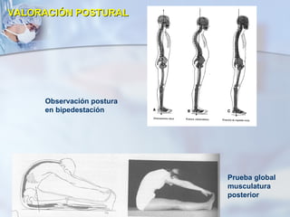 VALORACIÓN POSTURAL Observación postura en bipedestación Prueba global musculatura posterior 