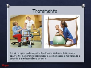 Tratamento

Estas terapias podem ajudar facilitando sintomas tais como o
spasticity, melhorando habilidades de comunicação e melhorando o
cuidado e a independência do auto.
Mayan

 