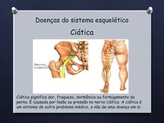 Doenças do sistema esquelético

Ciática

Ciática significa dor, fraqueza, dormência ou formigamento da
perna. É causada por lesão ou pressão no nervo ciático. A ciática é
um sintoma de outro problema médico, e não de uma doença em si.

 