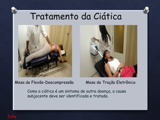 Tratamento da Ciática

Mesa de Flexão-Descompressão

Mesa de Tração Eletrônica

Como a ciática é um sintoma de outra doença, a causa
subjacente deve ser identificada e tratada.

Julia

 