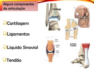 Cartilagem
Alguns componentes
da articulação
Ligamentos
Liquido Sinovial
Tendão
 
