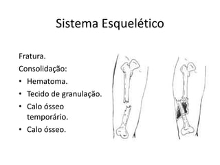 Sistema Esquelético Fratura. Consolidação: Hematoma. Tecido de granulação. Calo ósseo temporário. Calo ósseo. 