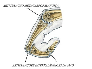 ARTICULAÇÃO METACARPOFALÂNGICA
ARTICULAÇÕES INTERFALÂNGICAS DA MÃO
 