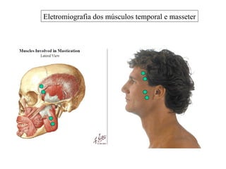 Eletromiografia dos músculos temporal e masseter
 