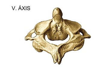 V. ÁXIS
 