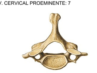 V. CERVICAL PROEMINENTE: 7
 