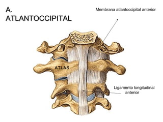 A.A.
ATLANTOCCIPITALATLANTOCCIPITAL
Membrana atlantoccipital anterior
Ligamento longitudinal
anterior
ATLAS
 