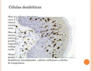 Estas pueden ser células dendríticas interesticiales, dendríticas plasmacitoides, dendríticas foliculares, dendríticas interdigitades , células veliformes o células de Langerhans. Células dendríticas Son macrófagos inmaduros cuya única función esta vinculada a los antígenos .Se encargan del procesamiento de estos. Son muy importantes y se encuentran en diversas estructuras y órganos como pueden ser la faringe, la piel, la vagina, la parte superior del esófago, la parte superior del cuello uterino .. 